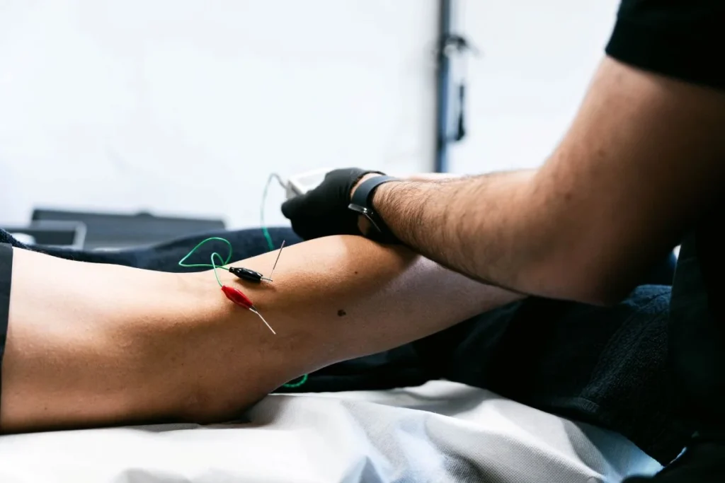 Tratamiento de fisioterapia invasiva con tecnología avanzada en Advance Fisio Girona